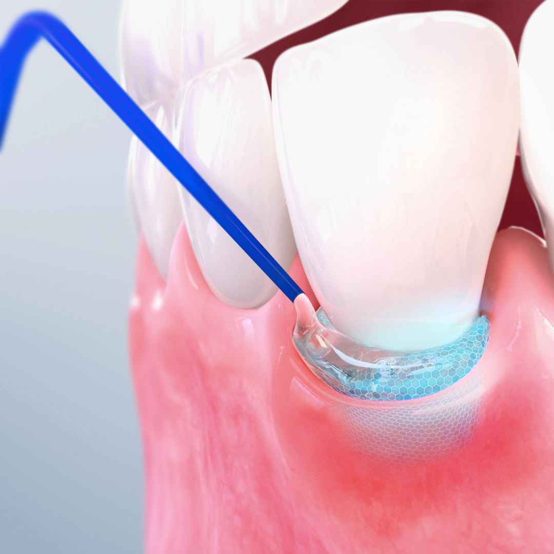 Pocket-X Gel – Промо пакет (3 опаковки)